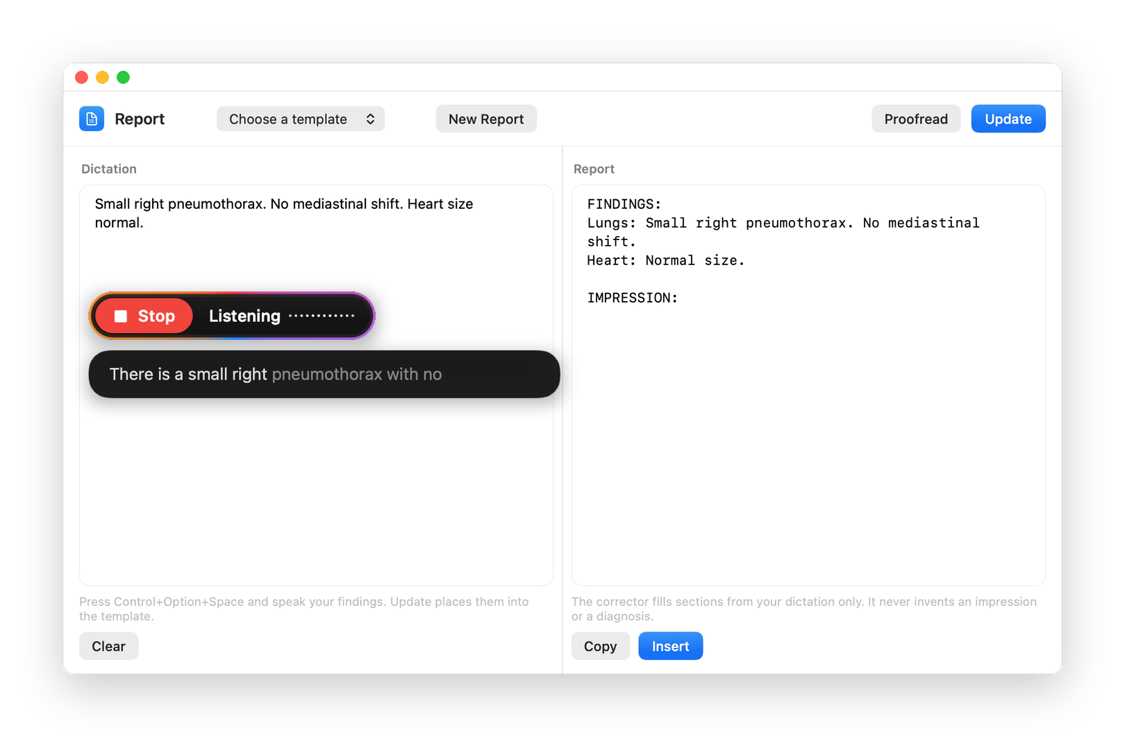 Spokn's report window, with the listening pill and the live preview of the words being spoken
